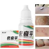 HOT Mole & Bőr szemölcs eltávolító folyadék Solution 100% Remover Skin Tags Warts Moles