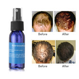 Liquido spray per crescita rapida dei capelli, perdita di capelli, marchio Yuda Pilatory Stop di Okeny
