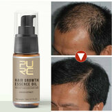 20ml Θεραπεία τριχόπτωσης Spray Ουσία μαλλιών Oil