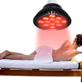 Лампа светодиодная E27 36W с возможностью регулировки яркости, инфракрасная, для лечения кожных заболеваний и облегчения боли, AC100-240V
