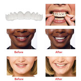 1 Par Odontologia Capas Cosméticas Sorriso Conforto Folheados Flex Dentes Suspensórios Superior + Inferior